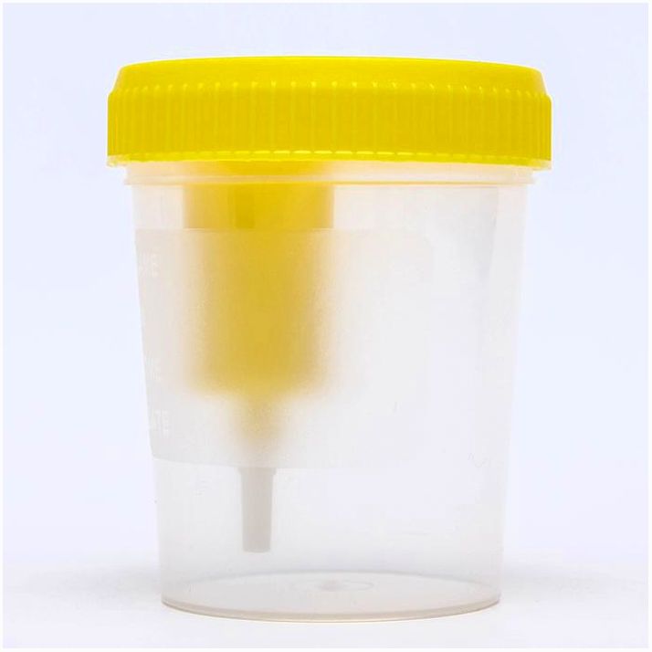 Контейнер стерильный со встроенным устройством для вакуумного забора мочи, 120 мл артикул анонс 7163782