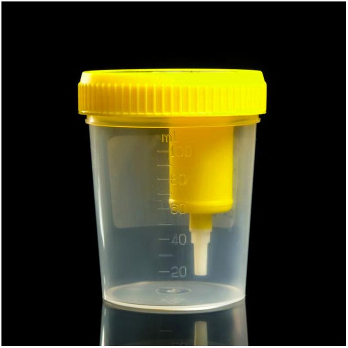 Картинка Контейнер стерильный со встроенным устройством для вакуумного забора мочи, 120 мл (№7163782) от магазина Мир детей Товары для Новорожденных