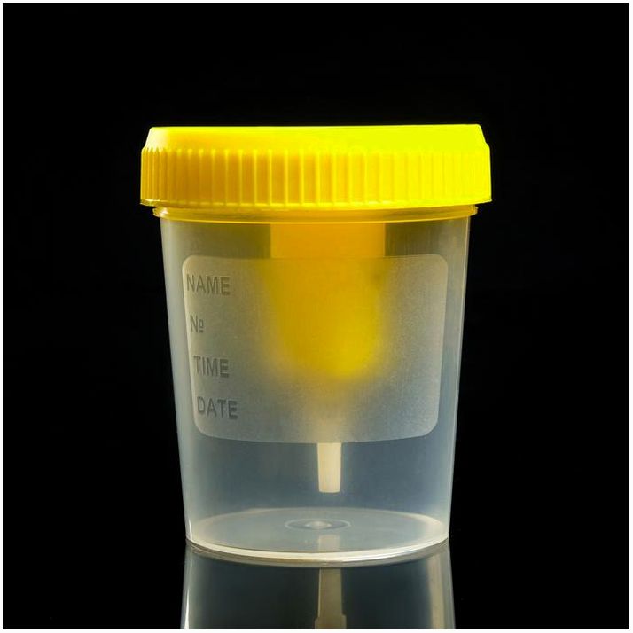 Картинка Контейнер стерильный со встроенным устройством для вакуумного забора мочи, 120 мл (№7163782) от магазина Мир детей Товары для Новорожденных